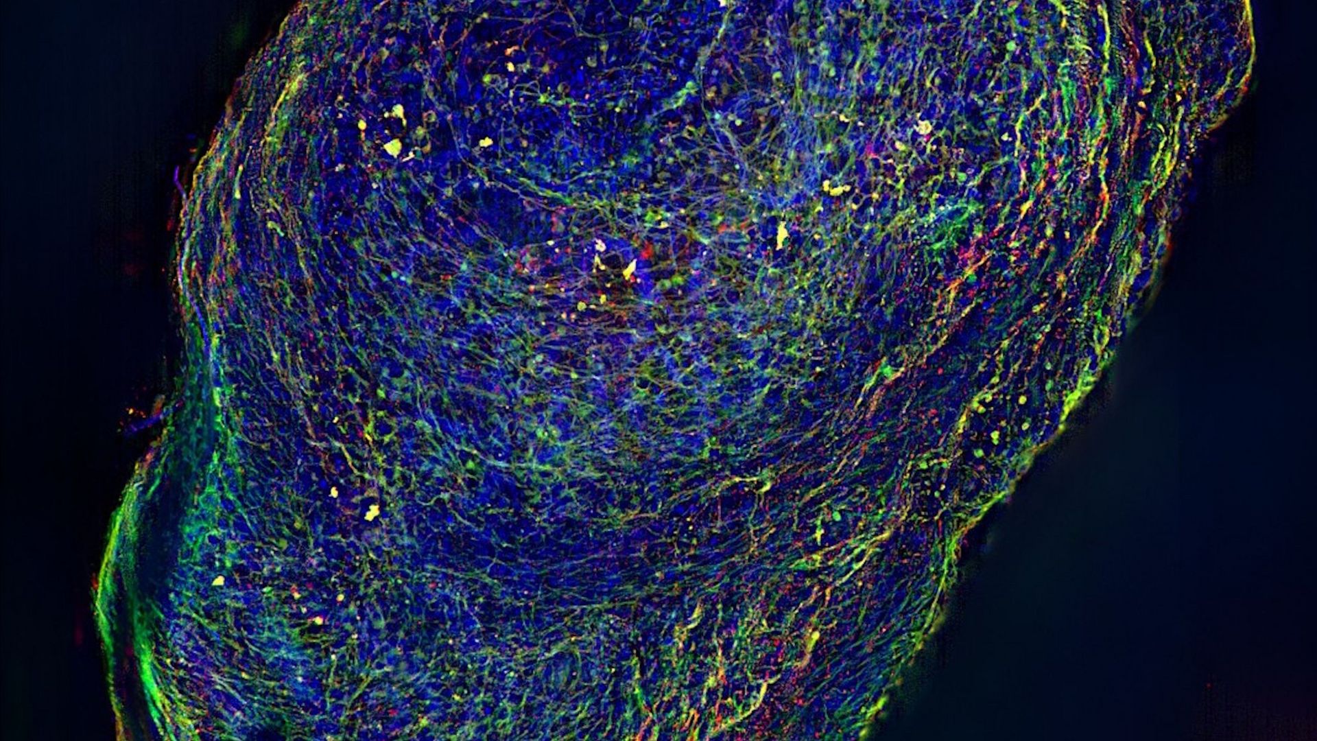Human iPSC derived mid brain organoid. Stained with MAP2 (green), DAPI (blue) and TH (red). Image acquired using THUNDER Imager Cell Spinning Disk; scale bar 200 µm. Courtesy of Dr Tanya Singh (Salman and Wade-Martins Lab), Department of Physiology, Anatomy and Genetics, University of Oxford.