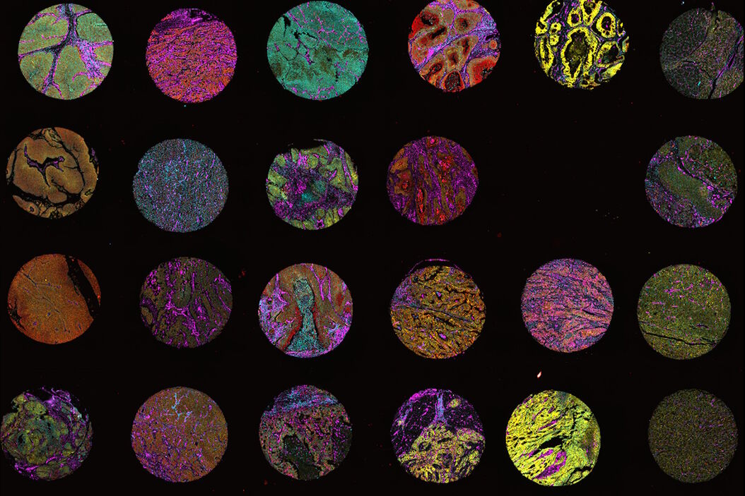 [Translate to German:] Multi-tissue array with 4 markers shown including DAPI, NaKATPase, PanCk, and Vimentin. Multi-tissue_array_with_4_markers.jpg