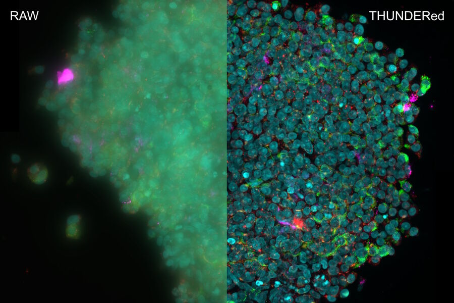 Figure 1: 3D reconstruction of an isolated human islet to experimentally examine the expression of IL-17, a proinflammatory cytokine, in individual human islet cells – high contrast images in real-time, free of haze or out of focus blur. Image courtesy of the Matthias Von Herrath Lab at the La Jolla Institute of Immunology, La Jolla, CA, USA.