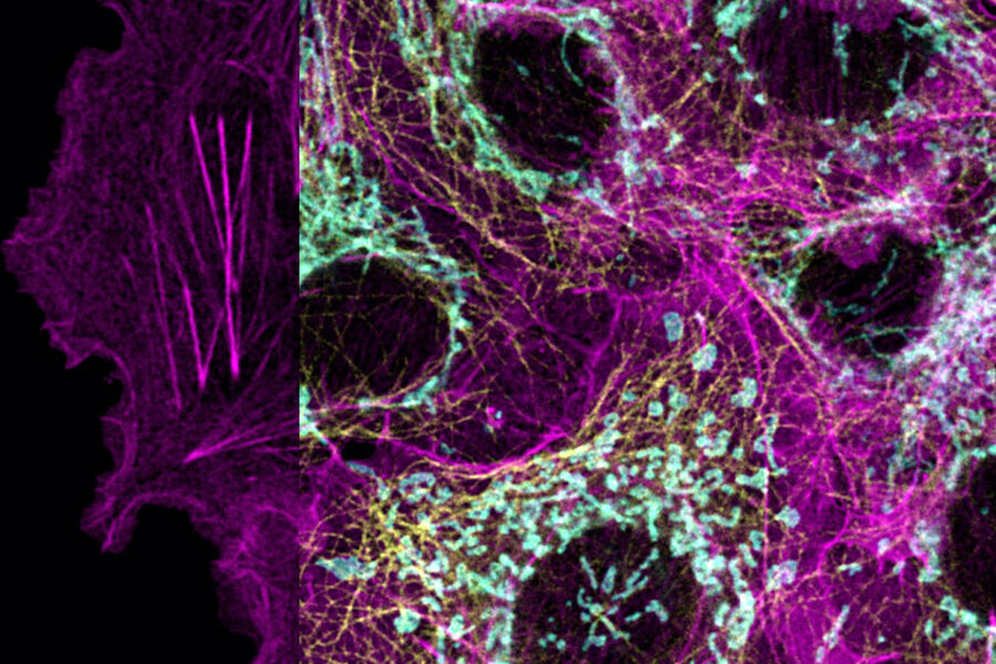 Cos-7 cells labeled with SiR-Actin (657 – 740nm detection range), AF750-Tom20 (760 – 790nm), AF790-Tubulin (810 – 850nm). 