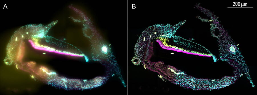 Tilescan 2D image of chicken cochlea taken with a THUNDER Imager Tissue. A) Raw epifluorescence image and B) the result after ICC [4,5]. Image courtesy of Dr. Amanda Janesick, California, USA.