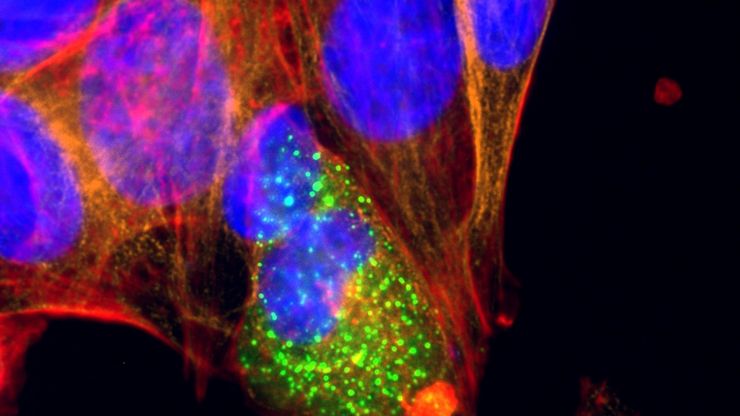 U2OS cells transfected with an Mx1-GFP plasmid (signal enhanced using Alexa Fluor 488-conjugared anti-GFP antibody) and co-stained for nuclear DNA (Hoechst 33342), microtubules (Alexa 555) and F-actin (ATTO 643). Image was captured on Mateo FL. U2OS cells transfected with an Mx1-GFP plasmid (signal enhanced using Alexa Fluor 488-conjugared anti-GFP antibody) and co-stained for nuclear DNA (Hoechst 33342), microtubules (Alexa 555) and F-actin (ATTO 643). Image was captured on Mateo FL.