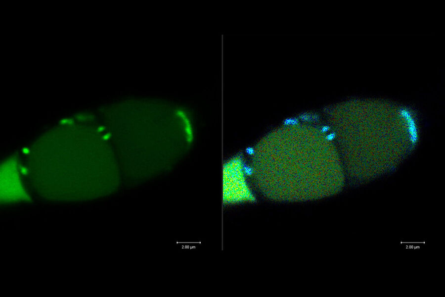 Mitochondria-localized GFP in Magnaporthe Oryzae (Rice blast fungus)