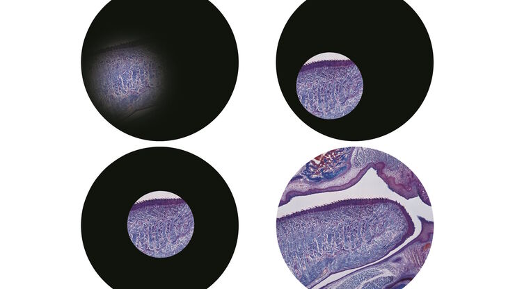 Steps of Koehler Illumination