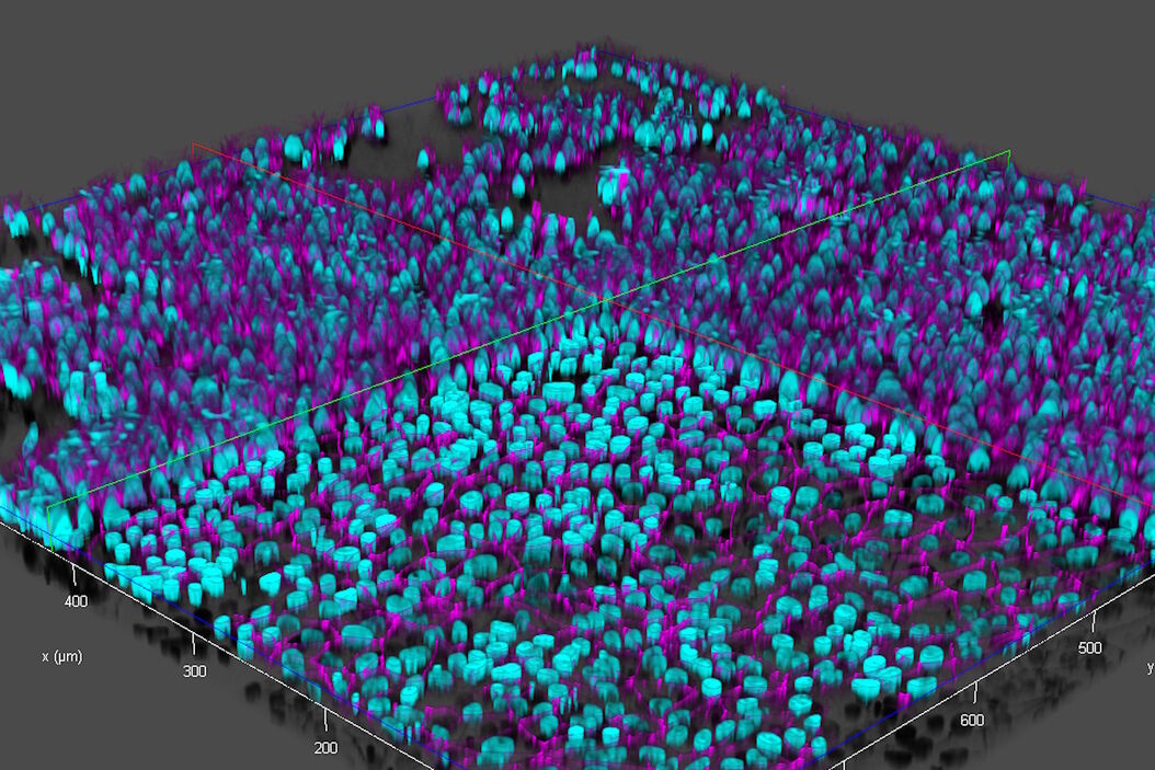 [Translate to chinese:] THUNDER image of brain-capillary endothelial-like cells derived from human iPSCs (induced pluripotent stem cells) where cyan indicates nuclei and magenta tight junctions. Brain-capillary_endothelial-like_cells_derived_from_human_iPSCs.jpg