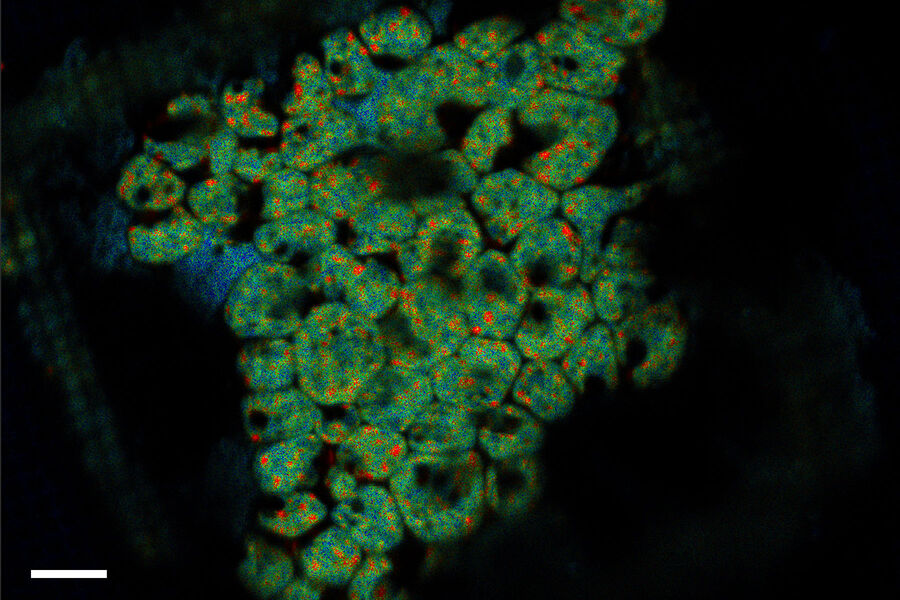 [Translate to chinese:] Clamydomonas TauSense Scalebar 10µm