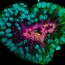 Patient-derived pulmonary neuroendocrine tumor organoid labelled with DAPI (cyan), phalloidin (magenta), beta-catenin (green), and ZO-1 (yellow). Sample courtesy of Marina Cuenca and Heleen Jungen, Talya Dayton lab, EMBL Barcelona.