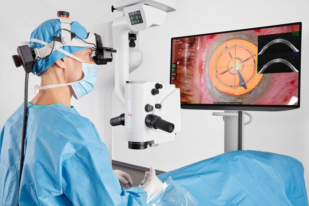 Csm Cataract MyVeo 34de9b1646