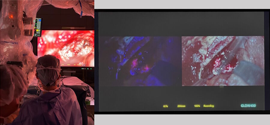 Fig. 1: The operation was performed in heads-up surgery, displayed on two screens simultaneously. It is also possible to display on a single screen (fig. 1). Image courtesy of Prof. Kondo. 