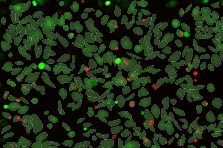 Live / Dead Assay analysis of U2OS cells treated with peroxide for 24 hours and imaged on Mica using a 10x HC PL Fluotar 10x/0.32 dry objective. Image courtesy of Dr. Patric Pelzer, Leica Microsystems CMS GmbH, Wetzlar, Germany.