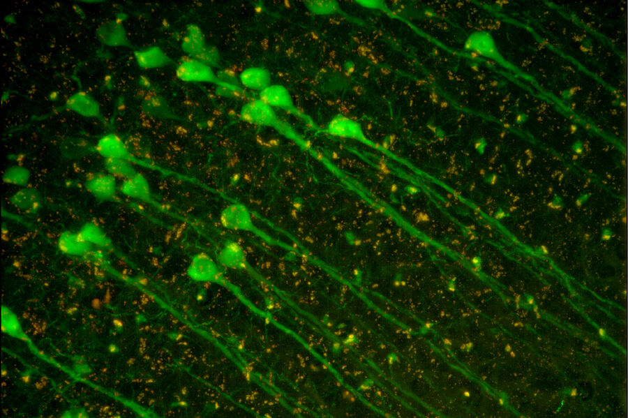 YFP mouse brain slice - THUNDER Imager Tissue 