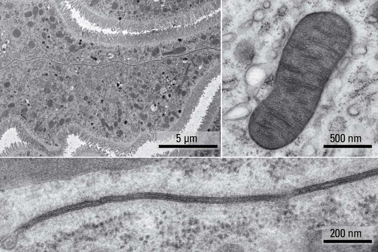 Superior ultrastructural preservation and TEM image contrast for Drosophila tissue. Micrographs courtesy of Drs Syed (NIH/NIDCR) and Bleck (NIH/NHLBI).
