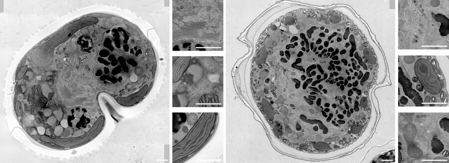 Abbildung 3: Mikroskopische Aufnahmen von Dinoflagellaten, die wie oben beschrieben bearbeitet wurden. Maßstabsbalken = 1 µm.