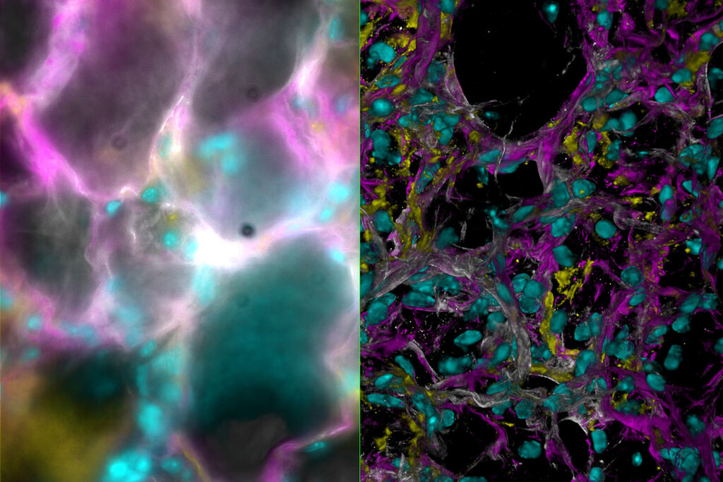 Csm Mouse Lung Tissue Stained For A Study Of Type I Alveolar Epithelial Cell AT1 Biology 3c39c6f23a