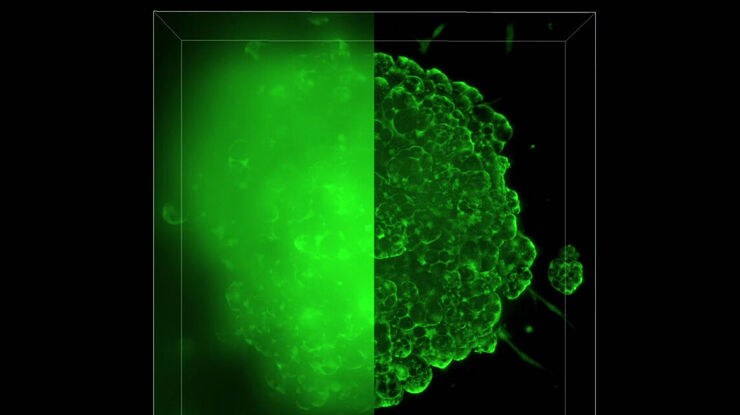 Csm Mouse Lung Organoids 3D 20 Fa30d3ddbf