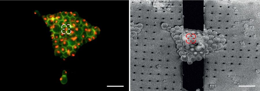 Targeting and retrieval. Fluorescent yeast cells in the cryo light microscope and FIB SEM. Left image: fluorescence image of yeast showing nucleoli in red and cell walls in green. A nucleolus is marked by a cross hair. Right image: The same position is retrieved in the FIB SEM to create a lamella containing the nucleolus of interest. The initial milling phase is shown. The milling windows above and below the lamella (black) are visible. Scale bar: 10µm. Images courtesy of Dr. Philipp Erdmann; yeast stem created by F. Wilfling, Max-Planck-Institute for Biochemistry, Martinsried, Germany.