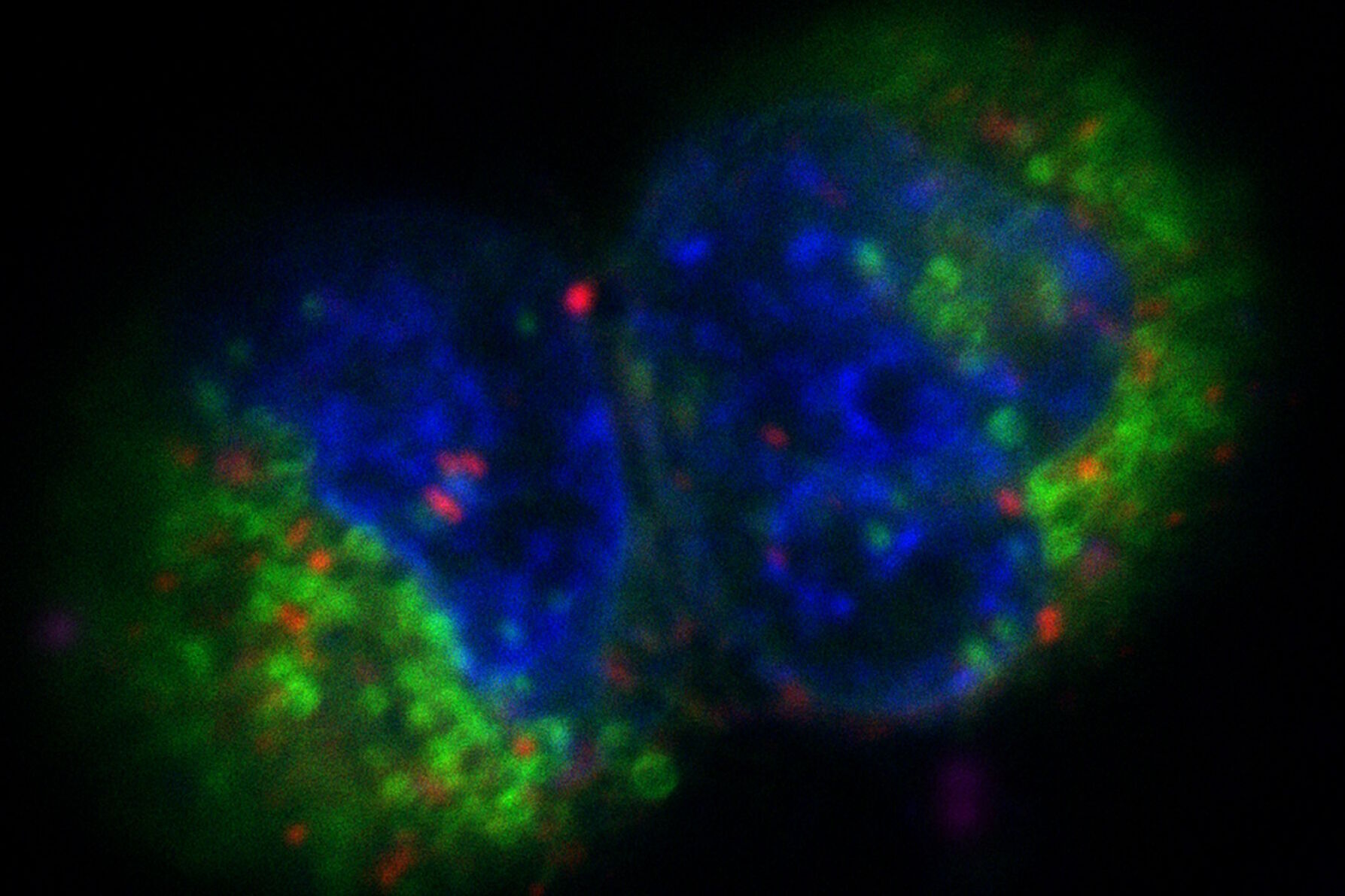 Before LIGHTNING Projection of a confocal z-stack. Sum159 cells, human breast cancer cells kindly provided by Ievgeniia Zagoriy, Mahamid Group, EMBL Heidelberg, Germany. Blue–Hoechst - indicates nuclei, Green–MitoTracker Green–mitochondria, and red–Bodipy - lipid droplets
