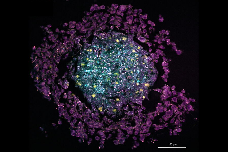 Multi-color SRS image of a tri-cellular cancer spheroid