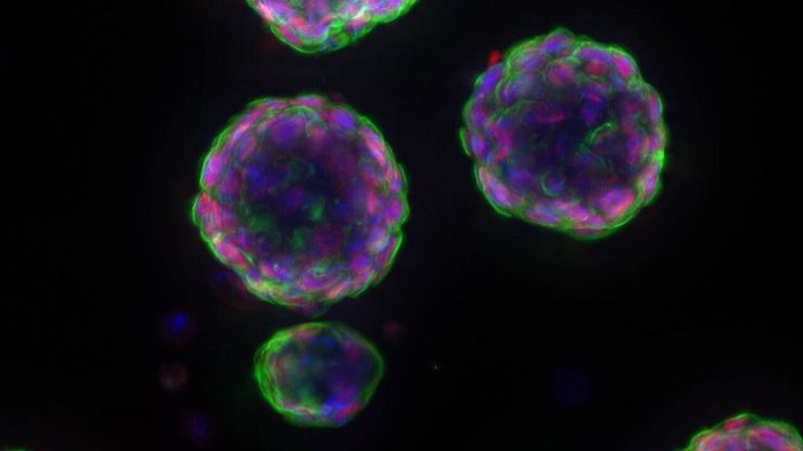 Murine esophageal organoids (DAPI, Integrin26-AF 488, SOX2-AF568) imaged with THUNDER Imager Cell. Courtesy of Dr. F.T. Arroso Martins, Tamere University, Finland.