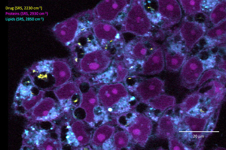 Image structures and events without a need for fluorescent dyes Multi-color SRS imaging reveals the subcellular distribution of a Raman-tagged pharmacological compound (yellow, SRS imaging at 2230 cm⁻¹), in the context of the endogenous lipids and proteins inside an otherwise unlabeled cellular sample. Sample courtesy of Dr. Matthäus Mittasch, Dewpoint Therapeutics GmbH.
