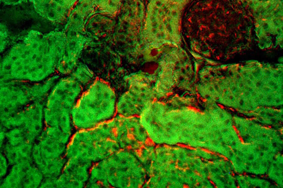 Multimodal nonlinear microscopy of kidney tissue.