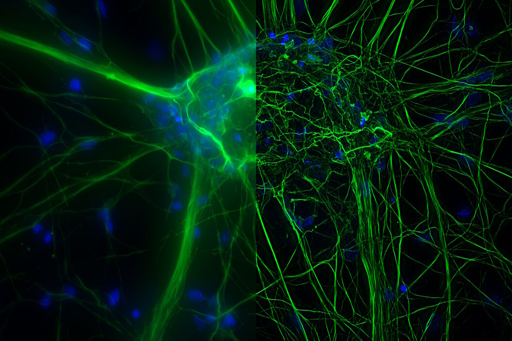 Microscopy for neuroscience research Microscopy_for_neuroscience_research.jpg