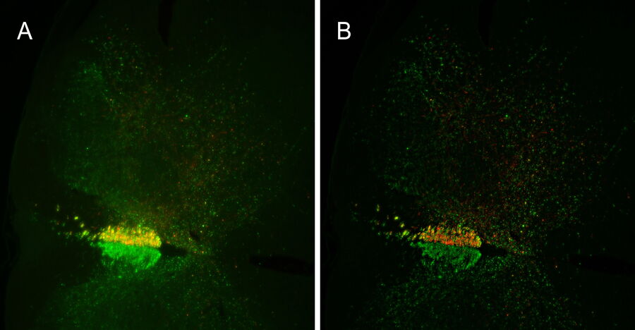 Screening of a mouse spinal cord section