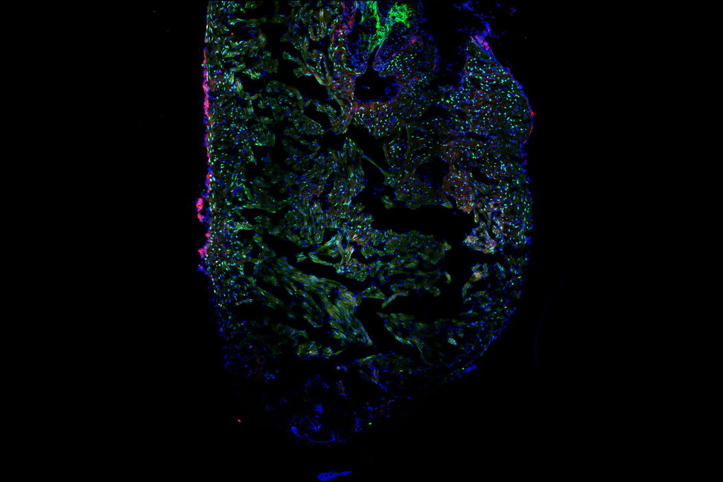 Image of a single slice taken from a zebrafish heart showing the ventricle with an injury in the lower area. Nuclei of all cells are indicated with blue, nuclei of the cardiomyocyte heart muscle cells with green, and the proliferating cells with red. Courtesy of Laura Peces-Barba Castaño, Max Planck Institute for Heart and Lung Research, Germany. Zebrafish_heart_showing_ventricle_with_injury_teaser.jpg