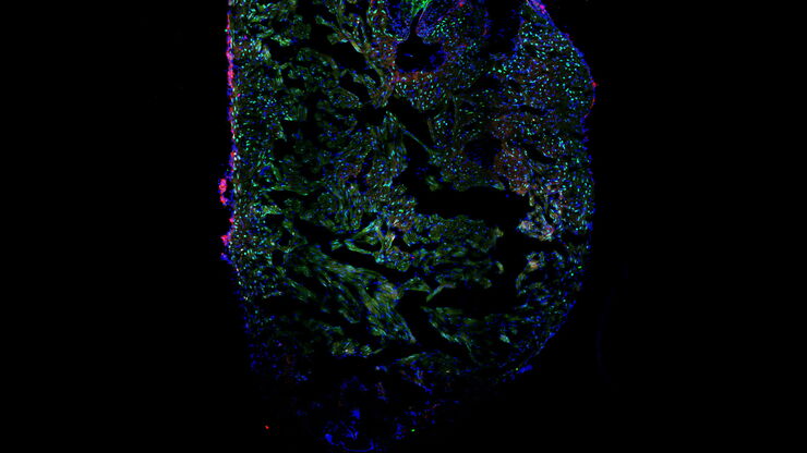 Image of a single slice taken from a zebrafish heart showing the ventricle with an injury in the lower area. Nuclei of all cells are indicated with blue, nuclei of the cardiomyocyte heart muscle cells with green, and the proliferating cells with red. Courtesy of Laura Peces-Barba Castaño, Max Planck Institute for Heart and Lung Research, Germany.