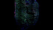 Image of a single slice taken from a zebrafish heart showing the ventricle with an injury in the lower area. Nuclei of all cells are indicated with blue, nuclei of the cardiomyocyte heart muscle cells with green, and the proliferating cells with red. Courtesy of Laura Peces-Barba Castaño, Max Planck Institute for Heart and Lung Research, Germany.