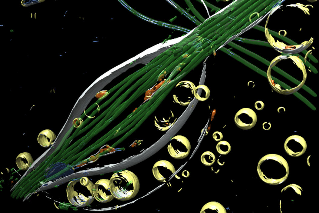  Advancing_Cell_Biology_with_Cryo-Correlative_Microscopy_teaser.jpg