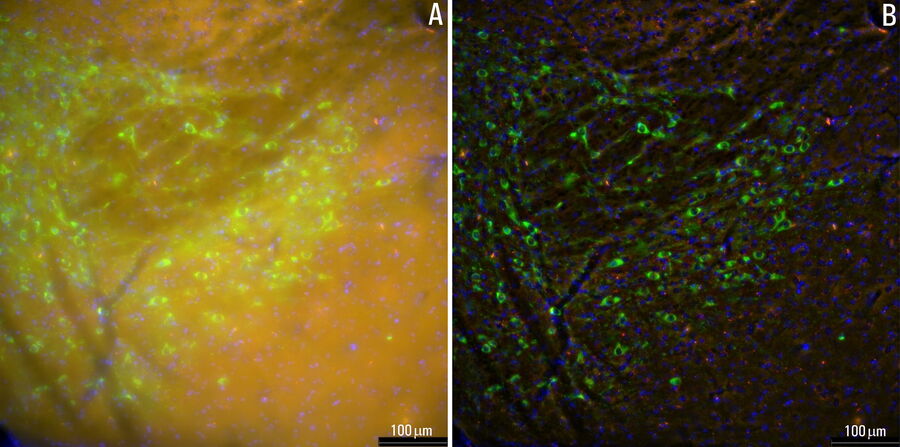 Raw widefield and THUNDER image of mouse brain showing D2-dopamine receptors