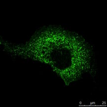 Example of a multicolor indirect IF, Protein A