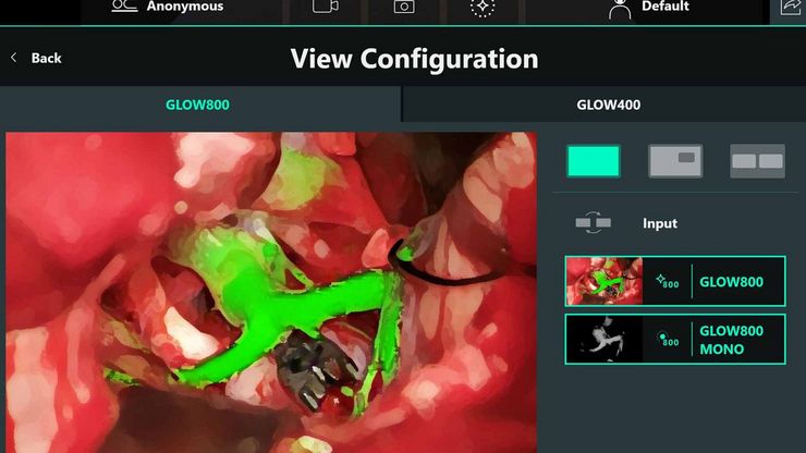 Interface utilisateur graphique unique pour l'utilisation du microscope et l'acquisition d'image