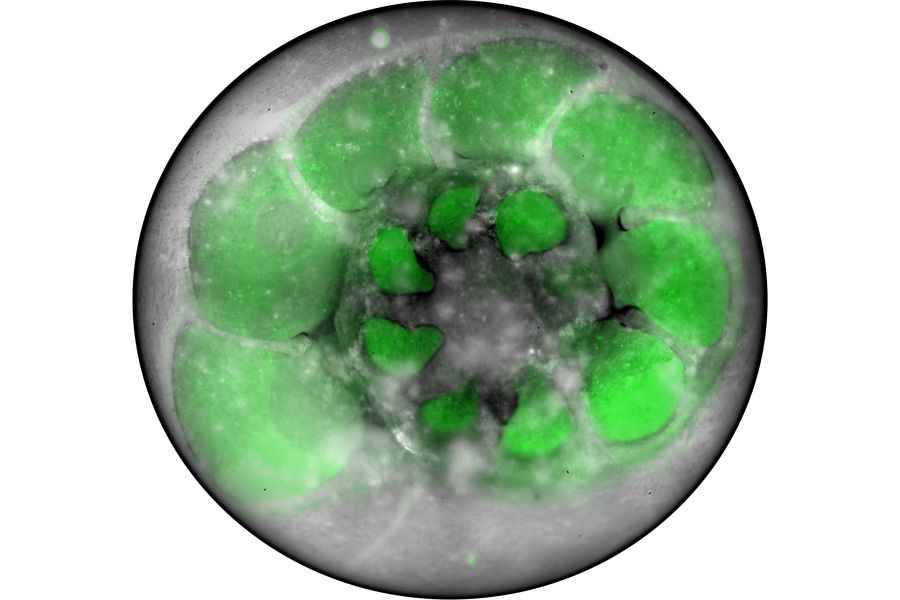 Foraminifera (Ammonia confertitesta) labeled with membrane-permeable calcein, high-pressure frozen in salt water using EM ICE. The sample was cryo-planed and targeted with the M205 on the Cryo-Fluo Enuity, then transferred under cryo conditions to the Cryo-Stellaris for widefield and confocal imaging, revealing details of the staining pattern. Image courtesy: David Evans, University of Southampton.