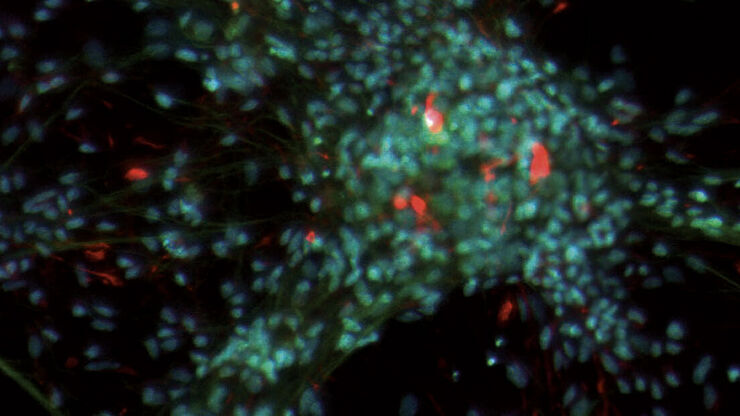 Neuronal cell culture stained with DAPI, beta III Tubulin–Cy2, Nestin-Cy3 (LMS Bioanalytik GmbH, Magdeburg, Germany). Blue indicates the nuclei of the cells, green neurons expressing beta III Tubulin, and red stem cells expressing Nestin. Image was acquired with a M205 FCA stereo microscope, LMT260 x/y stage, DFC3000 G camera and Fluocombi III at 400×.