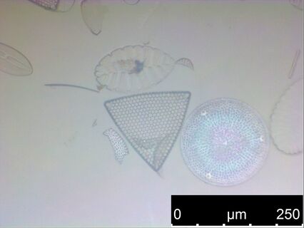 Fixed maritime diatoms on a glass slide.