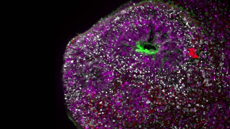 Csm Snap THUNDER Imager 3D Cell Culture HumBrainOrganoid B9d3c64140
