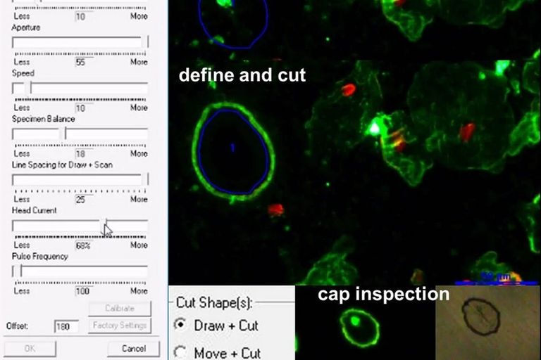 Tailor the system to the sample with reliable, reproducible laser settings.