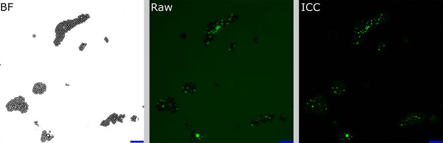 Single FOVs of the BF channel, raw fluorescence image and ICC processed image