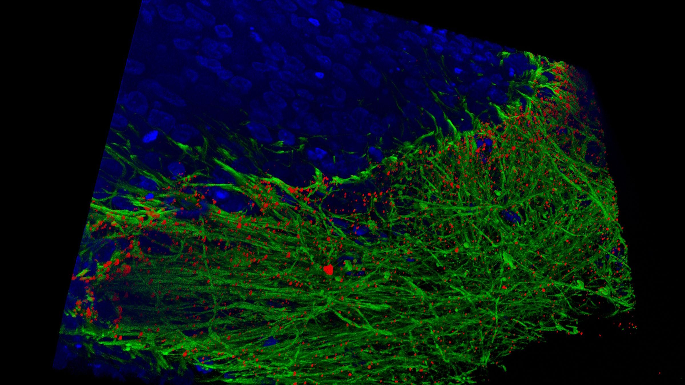 Human iPSC-derived mid brain organoid. Image acquired using THUNDER Imager Cell Spinning Disk. Courtesy of Dr Tanya Singh (Salman and Wade-Martins Lab), Department of Physiology, Anatomy and Genetics, University of Oxford.