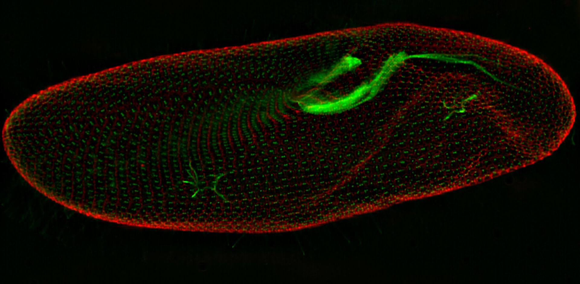 Widefield fluorescence microscope image of a paramecium after computational clearing.