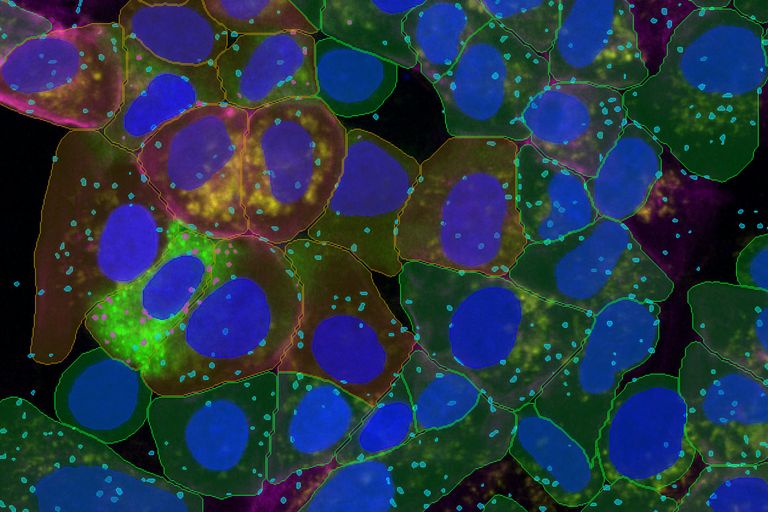 Four-color assay of cultured U2OS cells stained for nuclei (SPY555), actin (ATTO 647N), WGA (AlexaFluor 405), and MX1 (GFP). The cells are imaged with a HC PL APO 20x/0.75 dry objective on Mica ; and detected using Segment by Example. Image Courtesy of Dr. Patric Pelzer, Leica Microsystems CMS GmbH, Wetzlar, Germany