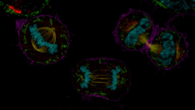 Traditional Confocal