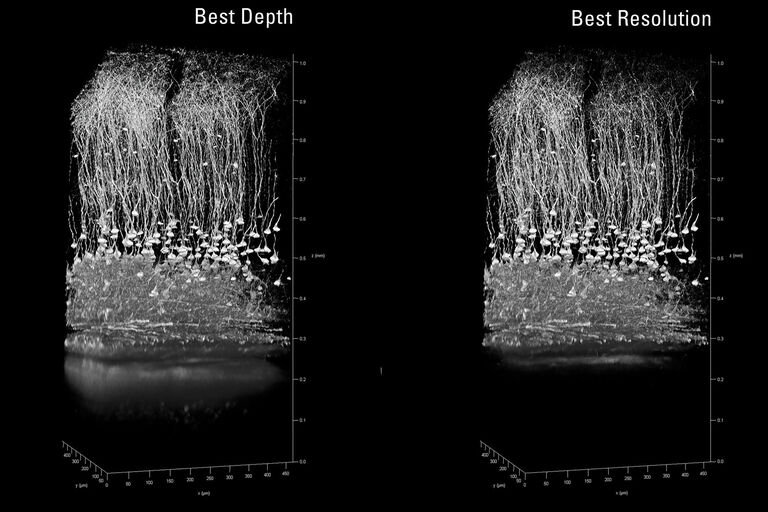 Mouse brain cortex, Thy1-eYFP. 20% improved penetration depth using Best Depth setting. IRAPO 25x1.0 W motCorr. Sample courtesy of Kevin Keppler, Light Microscope Facility, DZNE Bonn (Germany).