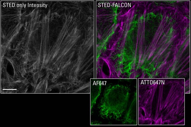 STED-FLIM per biologia cellulare: Lo STED 775 e la Phasor sepration automatica implementata in FALCON consentono di separare le specie con spettri sovrapposti utilizzando il tempo di vita della loro fluorescenza. Nelle cellule HEK marcate con la vimentina e l'actina, le informazioni di intensità ottenute attraverso la conta dei fotoni (grigie) mostrano entrambe le strutture come indistinte, mentre sono chiaramente distinguibili con STED-FLIM (verde, vimentina AF647; magenta, Actin ATTO 647N-falloidina). Scale bar: 4 µm. Campione su gentile concessione di Sebastian Hänsch, Stephanie Weidtkamp-Peters, CAI, Düsseldorf, Germania.