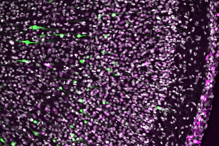 Electroporated nerve cells (green), specific neuronal markers (magenta) and cell nuclei (white), computational cleared. Electroporated nerve cells (green), specific neuronal markers (magenta) and cell nuclei (white), computational cleared.