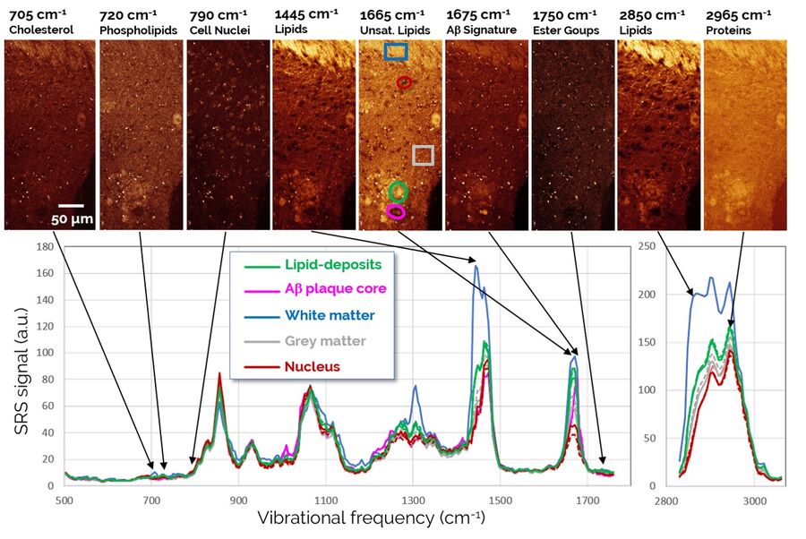 SRS spectroscopic imaging of brain tissues.