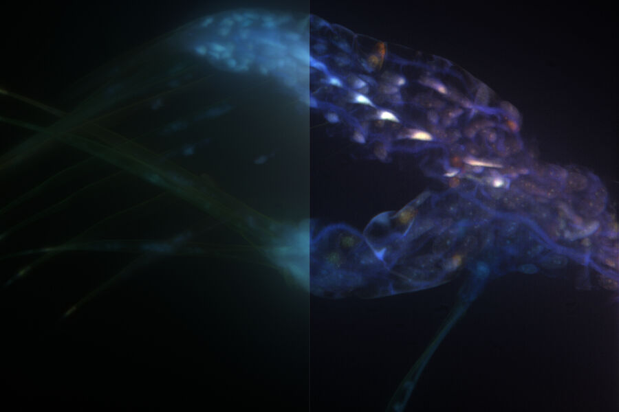 Brine Shrimp leg - THUNDER Imager 3D Cell Culture