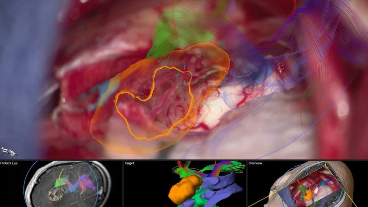 Connexion aisée aux dispositifs chirurgicaux compatibles